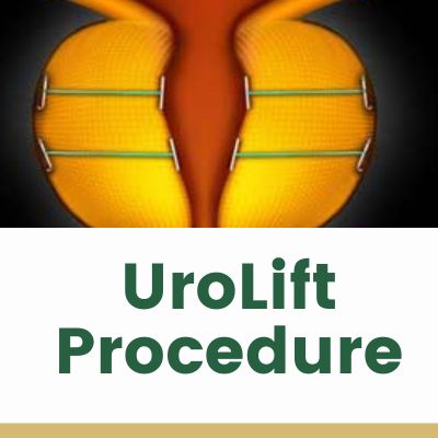 Top Cyberknife Treatment D